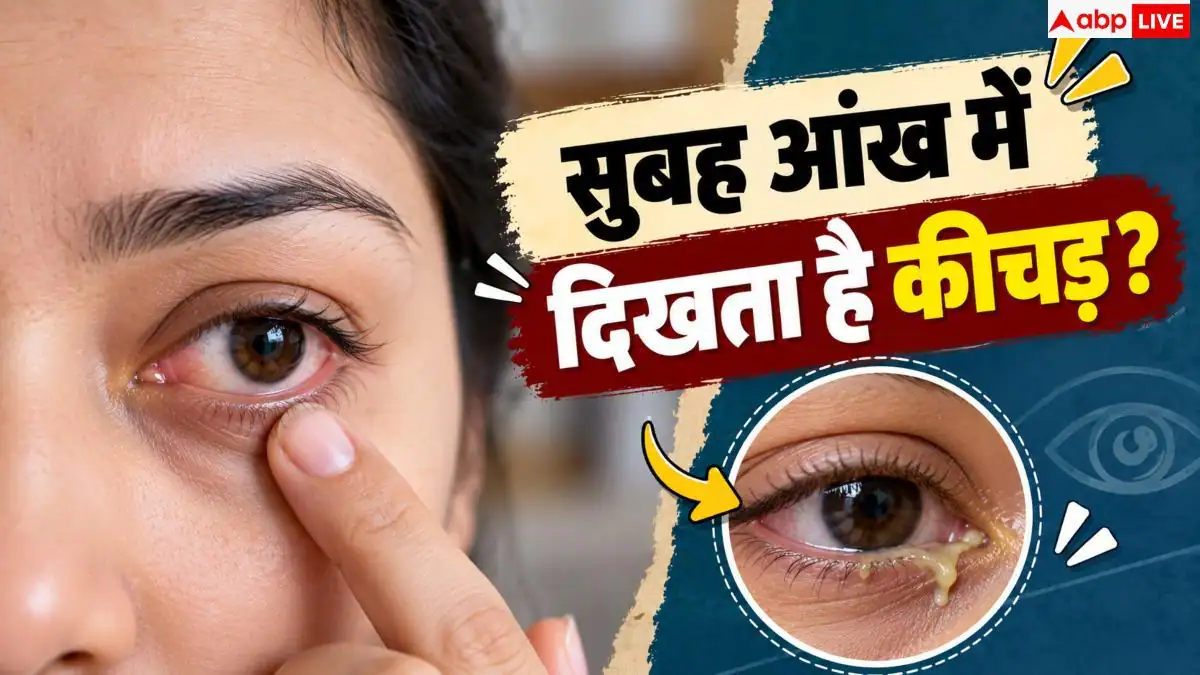 Eye Discharge: सुबह-सुबह आंखों में दिख रहा ज्यादा कीचड़, जानें कब है खतरे का संकेत?