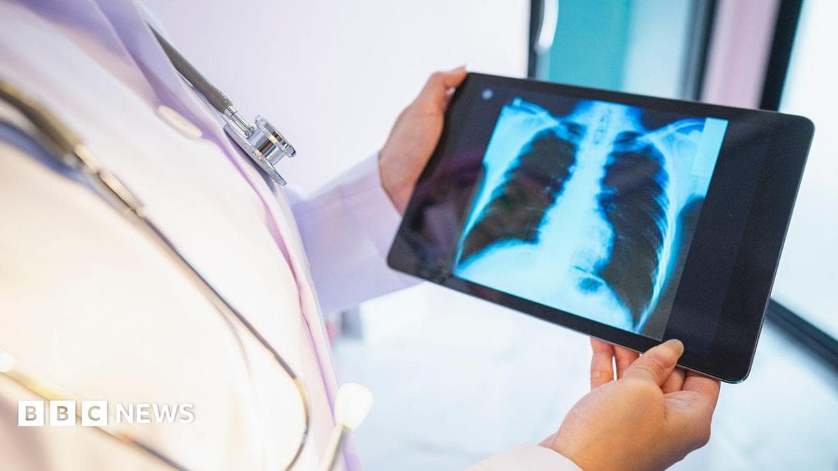 Shropshire lung cancer screening programme reaches 10,000 milestone