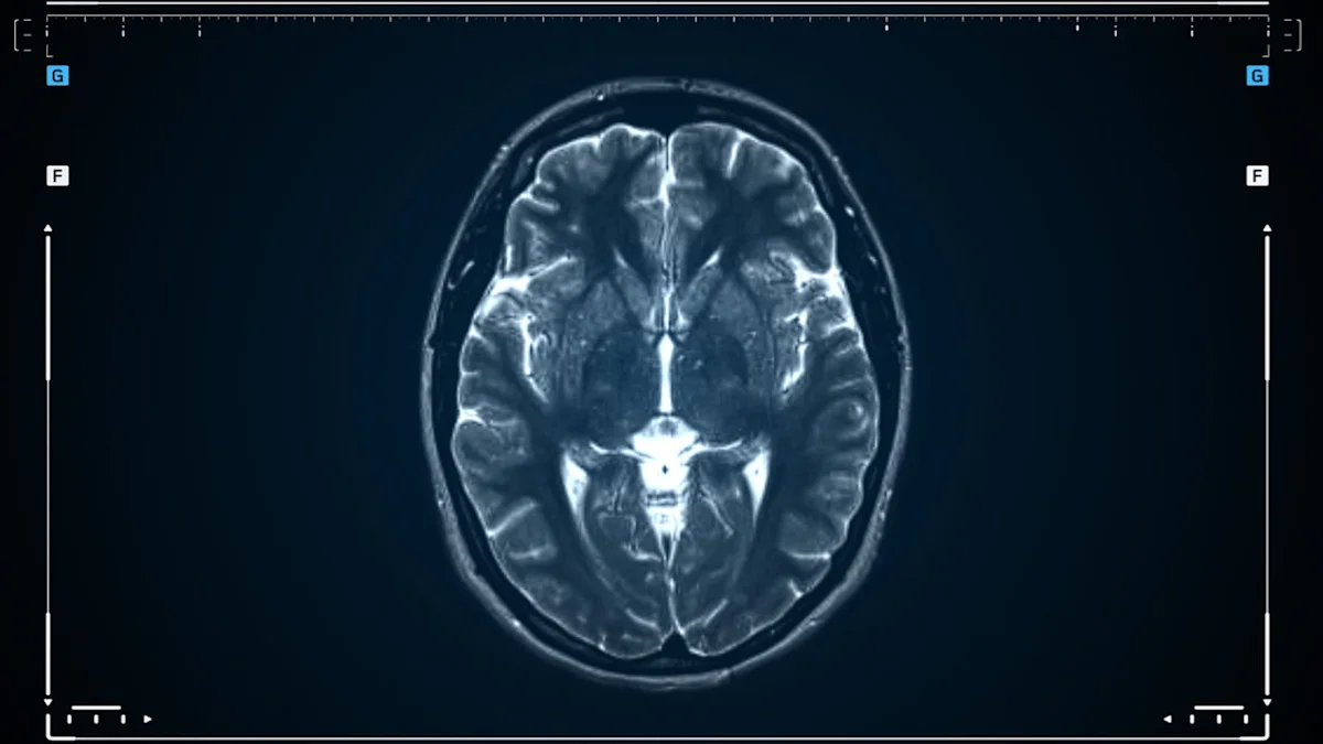 Human brain is actually two separate organs, scientists find