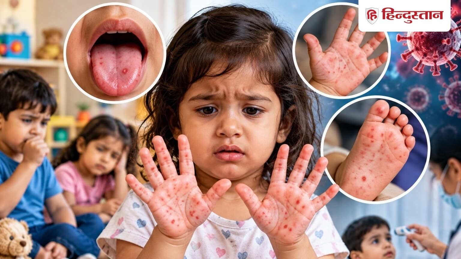 बच्चों पर मंडरा रहा HFMD का खतरा; सबसे ज्यादा चपेट में इस उम्र के बच्चे, जानें लक्षण